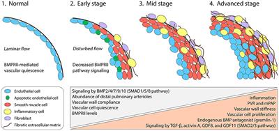 Therapeutic Approaches for Treating Pulmonary Arterial Hypertension by Correcting Imbalanced TGF-β Superfamily Signaling